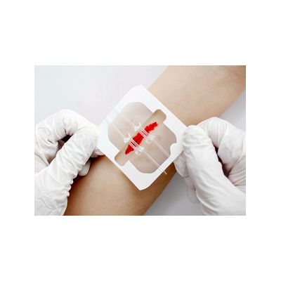 Serie de cierre de piel de heridas