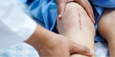 Wound Dressing Raw Material