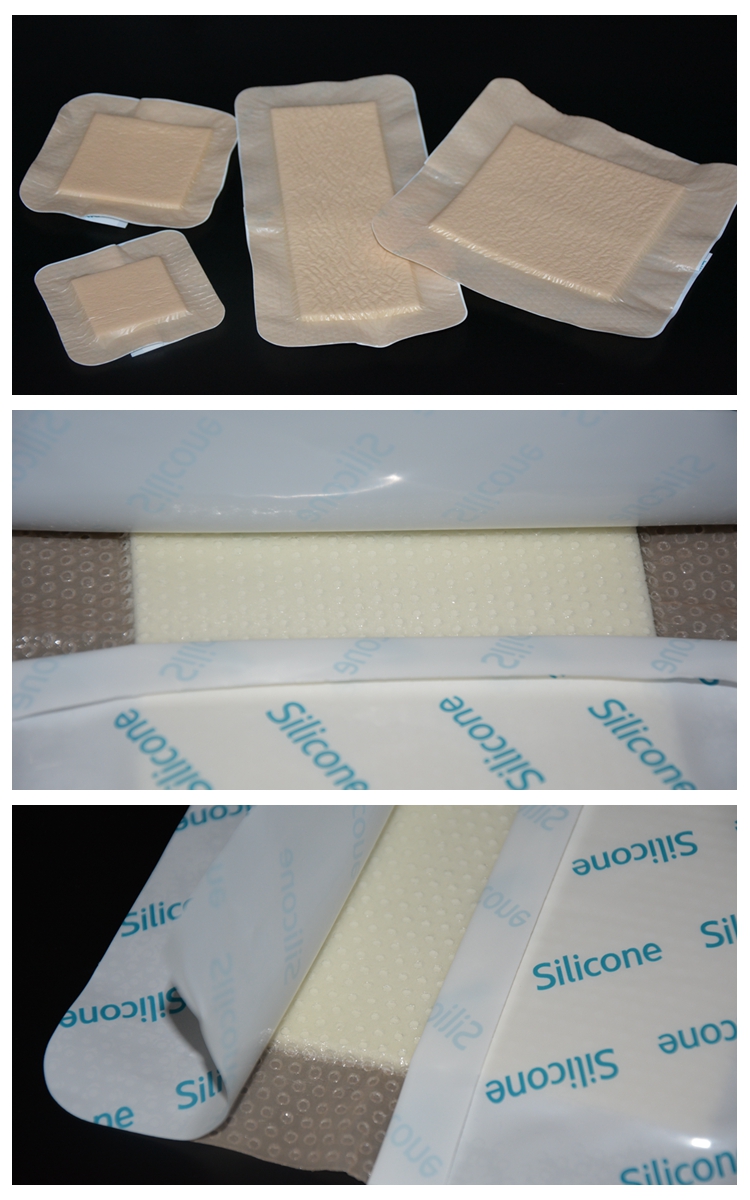 Silicone dressing high absorbent selfadherent silicone foam dressing