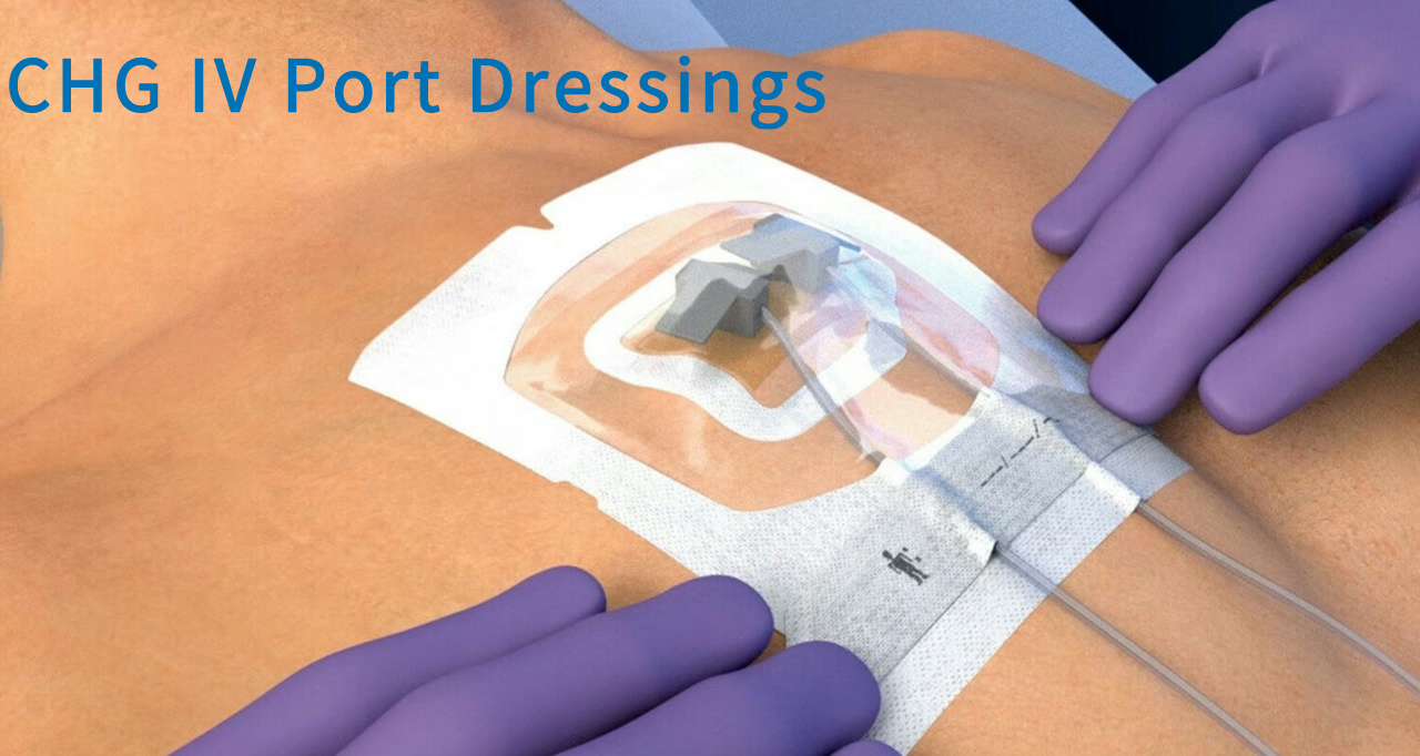 CHG Chlorhexidine Gluconate Dressing IV Port Dressings CHG Chlorhexidine Gluconate Dressing IV Port Dressings