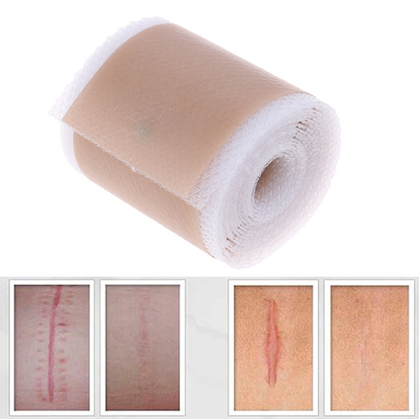 Silicone tape for scars silicone scar treatment