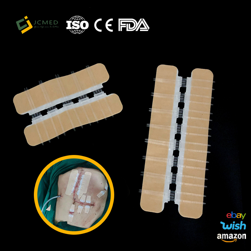 Buy zipstitch adhesive skin wound closure device popular sizes